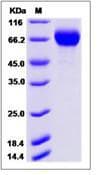Influenza A Virus H7N9 NA Protein (Recombinant His, N-Terminal)