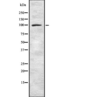 SNCAIP / Synphilin 1 Antibody
