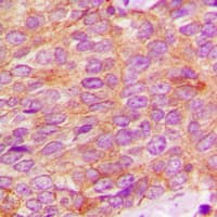 KLK3 / PSA Antibody (Internal)