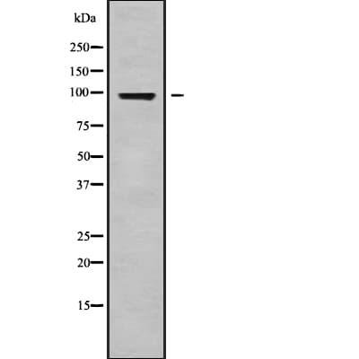 AKAP82 / AKAP4 Antibody