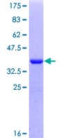 Human PRRX2 / PRX2 Protein (Recombinant GST, N-terminus)