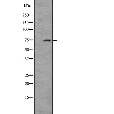 Polyclonal Rabbit anti-Human IL12RB1 / CD212 Antibody (IHC, WB)