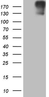 ROS1 / ROS Antibody (aa1882-2125, clone OTI1A1)