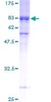 Human MEIS3 Protein (Recombinant GST)