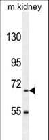 Polyclonal Rabbit anti-Human BUD13 Antibody (aa462-490, IHC, WB)
