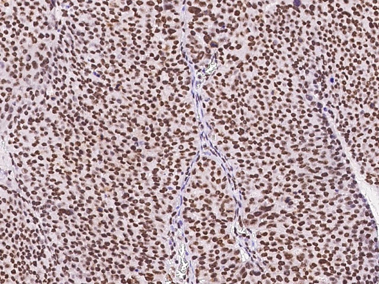 SIN3A Antibody (N-Terminus)
