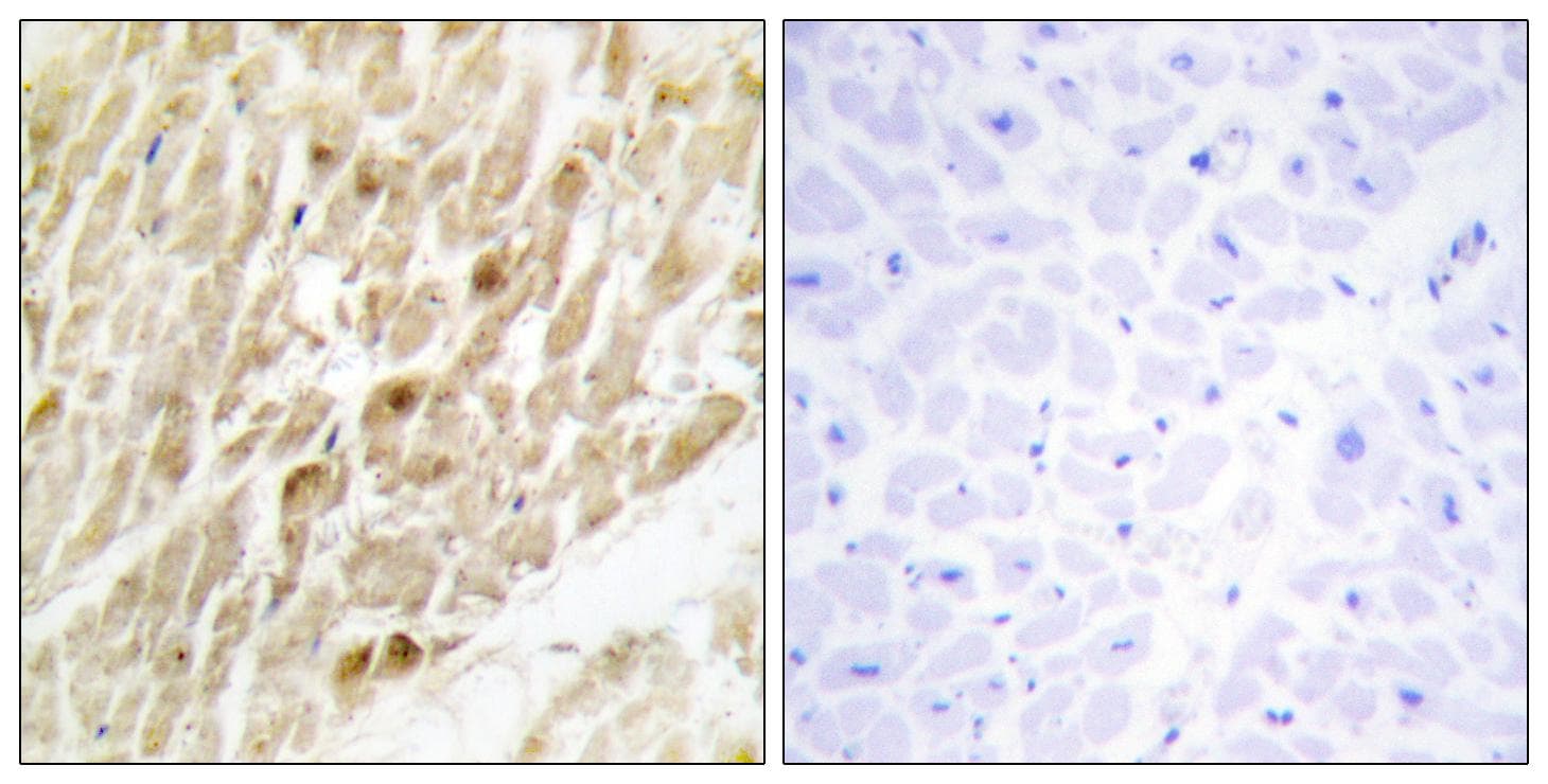 Polyclonal Rabbit anti-Human CBFB Antibody (IHC, WB)