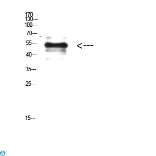 Vimentin Antibody