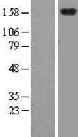 Human ZFYVE9 / SARA Protein (Over-Expression Lysate Myc-DDK (Flag))