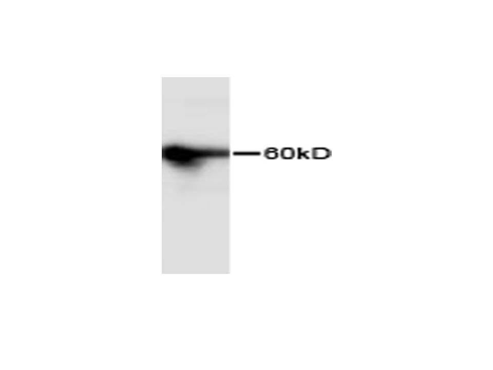 PathPlus™ ENO1 / Alpha Enolase Antibody (clone 9)