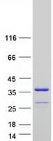 Human NT5C3B / NT5C3L Protein (Recombinant Myc-DDK (Flag))