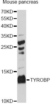 Polyclonal Rabbit anti-Human DAP12 Antibody (WB)