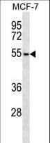 ARMCX1 Antibody (aa239-268)