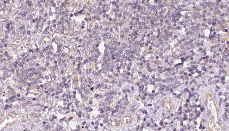 SULT1C2 / Sulfotransferase 1C2 Antibody