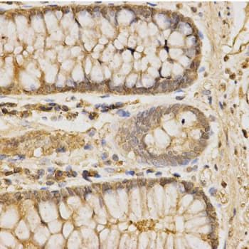 GLB1 / Beta-Galactosidase Antibody