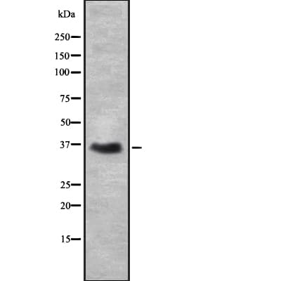 Polyclonal Rabbit anti-Human DAZL Antibody (WB)