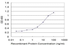 ARA70 / NCOA4 Antibody (clone 1E5)