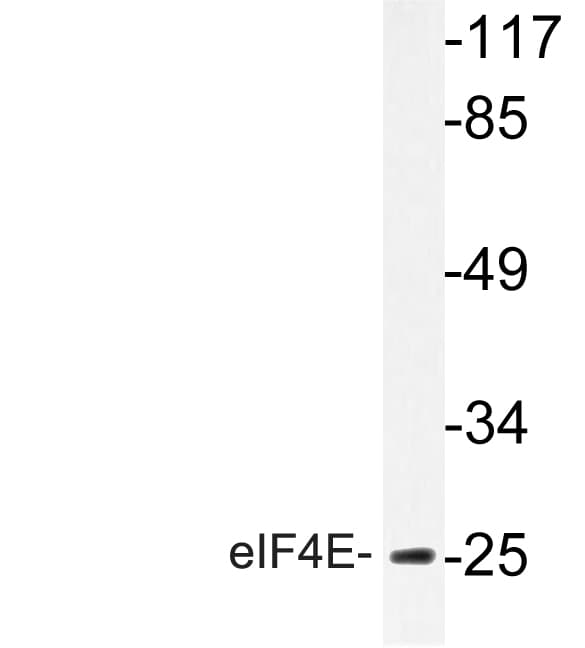 EIF4E Antibody (Arg215)