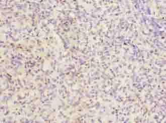 ITGAL / CD11a Antibody