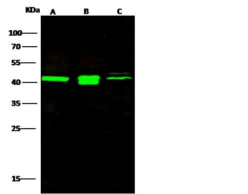 Polyclonal Rabbit anti-Human PREX1 / P-REX1 Antibody (Preservative Free, WB)