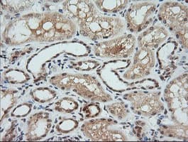 Monoclonal Mouse anti-Human MAP2K1 / MKK1 / MEK1 Antibody (clone OTI3E6, IHC, IF, WB)