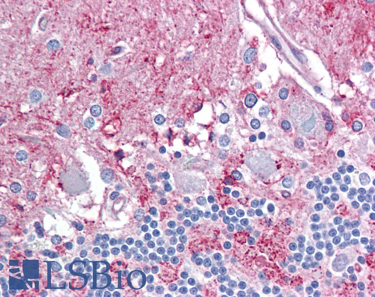 IHC-plus™ Polyclonal Rabbit anti-Human NPY5R Antibody (aa221-270, IHC, IF, WB)