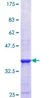 Human ETHE1 Protein (Recombinant GST, N-terminus)