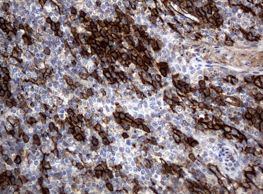 PECAM-1 / CD31 Antibody (clone UMAB29)