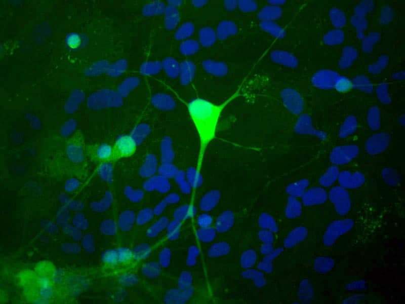 UCHL1 / PGP9.5 Antibody