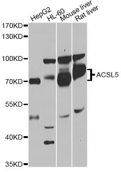 Polyclonal Rabbit anti-Human ACS5 / ACSL5 Antibody (IHC, WB)