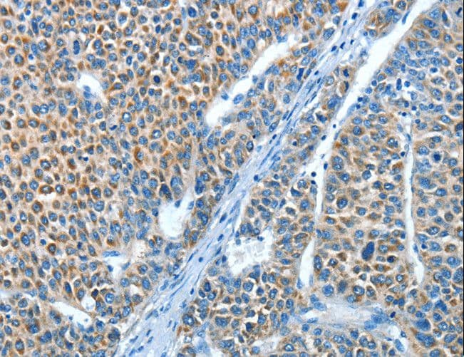 Polyclonal Rabbit anti-Human ADRA1B / Adrenoceptor alpha 1B Antibody (IHC, WB)