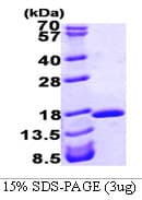 Human I-FABP / FABP2 Protein (Recombinant His)