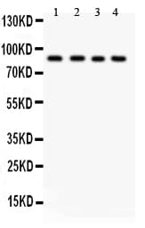 IKBKB / IKK2 / IKK Beta Antibody