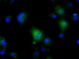 Monoclonal Mouse anti-Human NIT2 Antibody (clone OTI5A3, IHC, IF, WB)