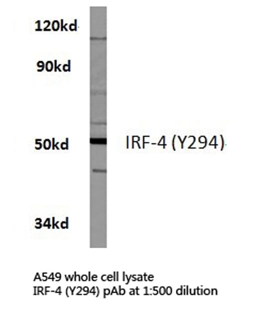 IRF4 Antibody (Tyr294)
