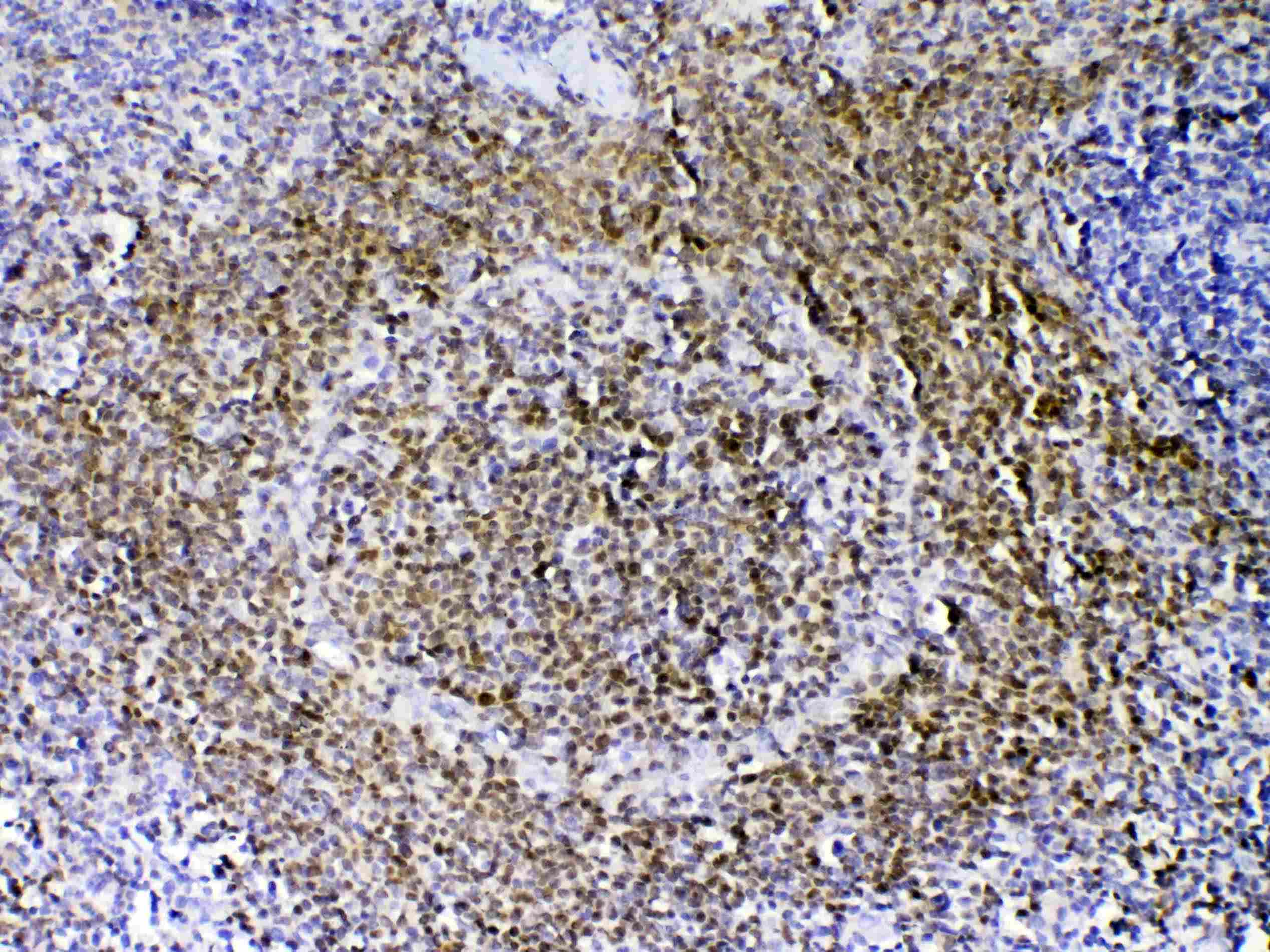 Polyclonal Rabbit anti-Human PAX5 Antibody (IHC, WB)