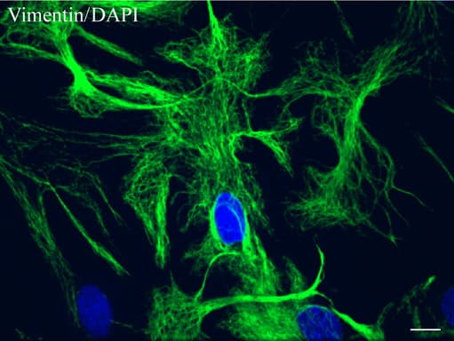 Vimentin Antibody (clone UMAB160, Carrier-free)