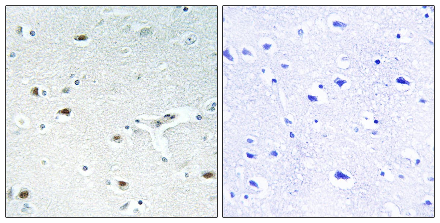 RB1 / Retinoblastoma / RB Antibody (aa601-650)