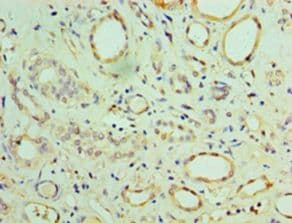 MIA40 / CHCHD4 Antibody (aa1-142)