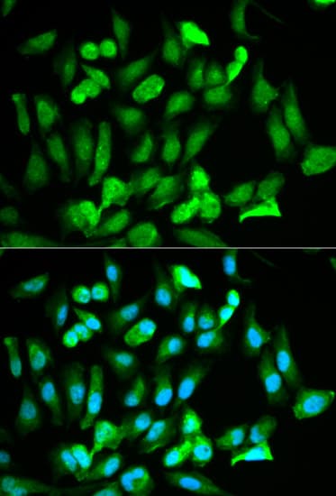 Polyclonal Rabbit anti-Human ERG Antibody (IHC, IF, WB)