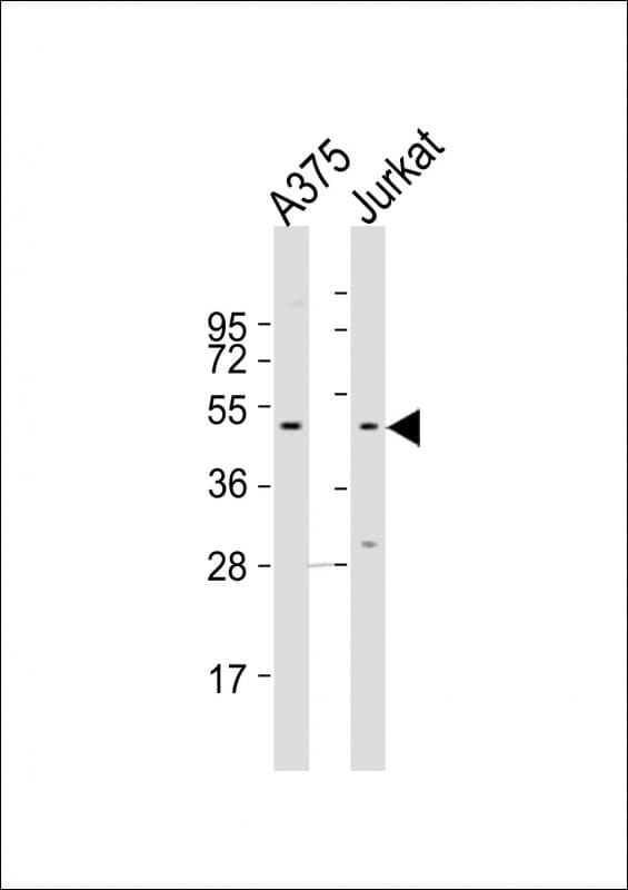 CCR1 Antibody (aa13-44)
