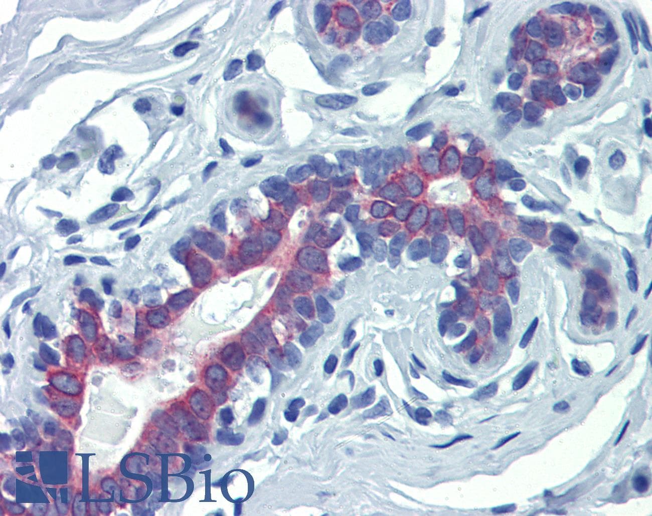 LIMD1 Antibody (N-Terminus)