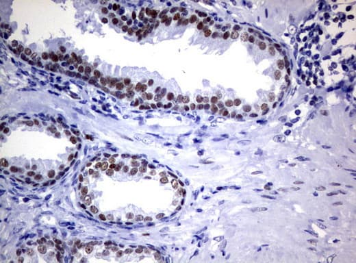 FOXP1 Antibody (clone UMAB89)
