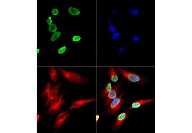 Polyclonal Rabbit anti-Human HIST4H4 Antibody (Ac-Lys12, IHC, IF, WB)