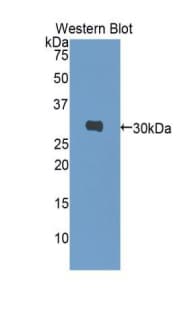 CA1 / Carbonic Anhydrase I Antibody (aa2-261, APC)