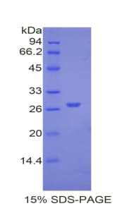 Mouse AHSG / Fetuin A Protein (Recombinant His)