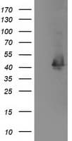 IHC-plus™ MAPRE2 / EB2 Antibody (clone 1F3)