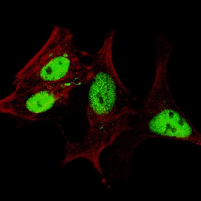 IHC-plus™ Polyclonal Rabbit anti-Human LIN28A / LIN28 Antibody (aa108-138, IHC, IF, WB)