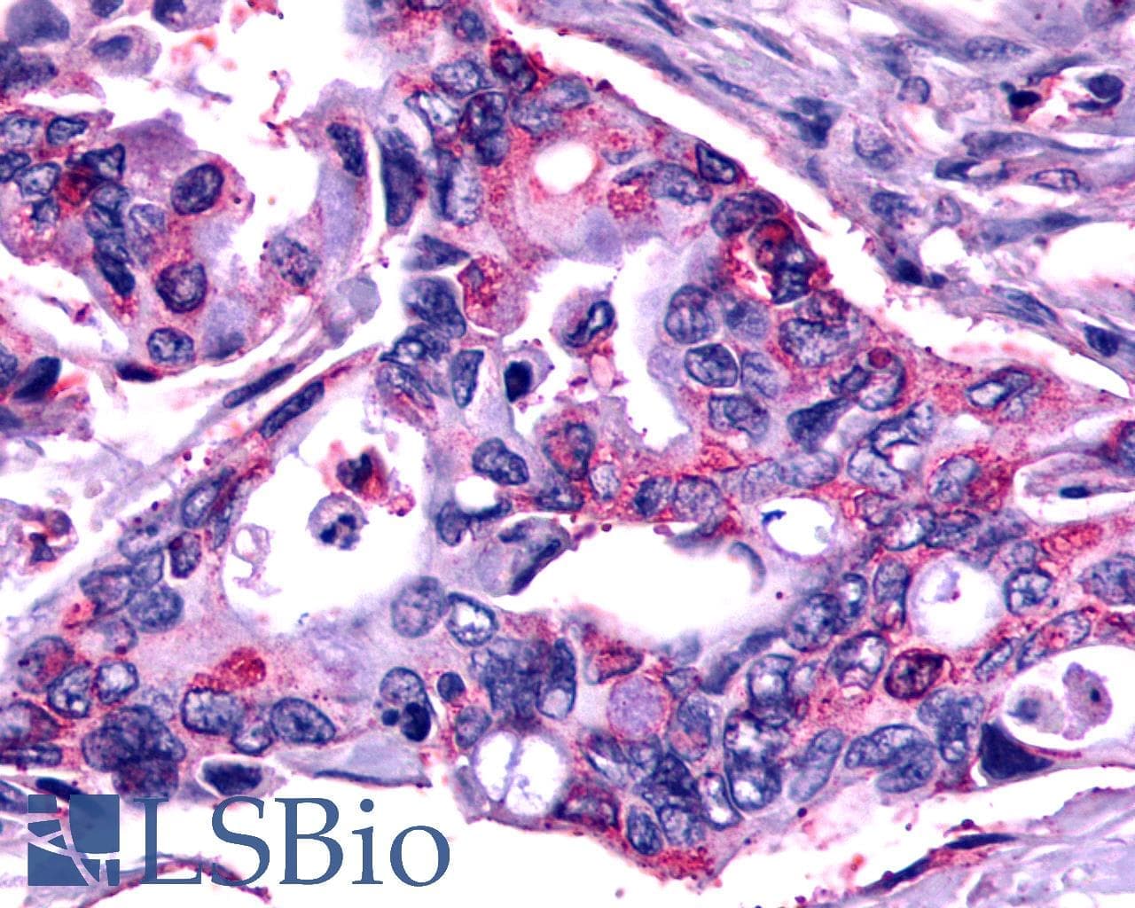IHC-plus™ Polyclonal Rabbit anti-Human FZD2 / Frizzled 2 Antibody (N-Terminus, IHC)