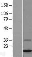 Human MGP / Matrix Gla-Protein (Over-Expression Lysate Myc-DDK (Flag))